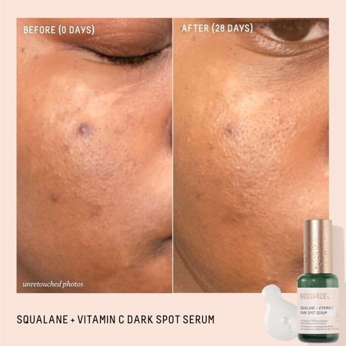 Biossance Squalane + Vitamin C Dark Spot Face Serum – 10% Vitamin C Serum & White Shiitake – Hydrating, Fragrance-Free, Non-Irritating, for Daily Use for All Skin Types - Image 2